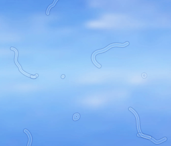 날파리증