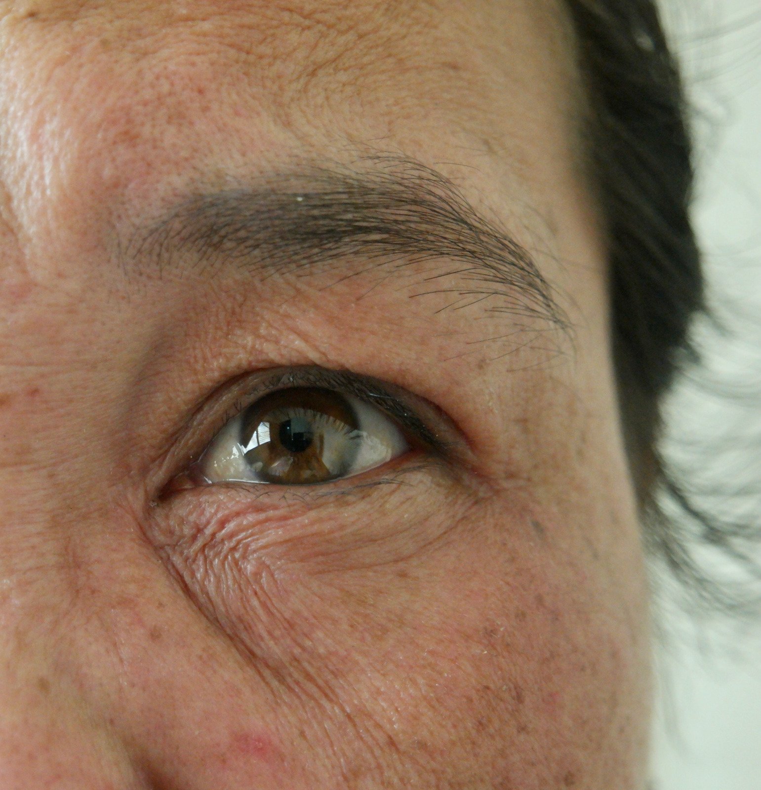 눈가 &amp; 입가 주름 예방 및 개선법