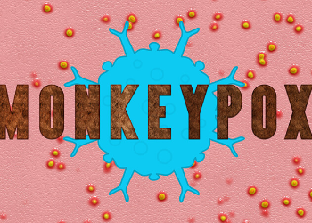 수포와 바이러스 그림, monkeypox 글씨 써진 그림