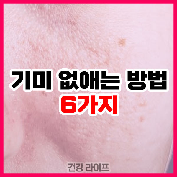 기미 없애는 방법 6가지