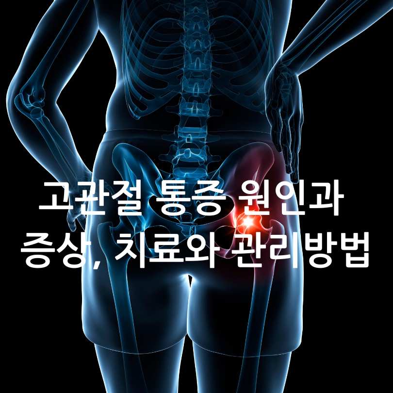고관절통증 증상 관리법