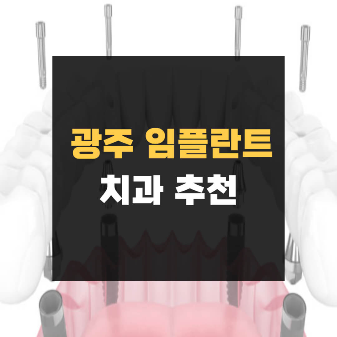광주 임플란트 치과 잘하는 곳