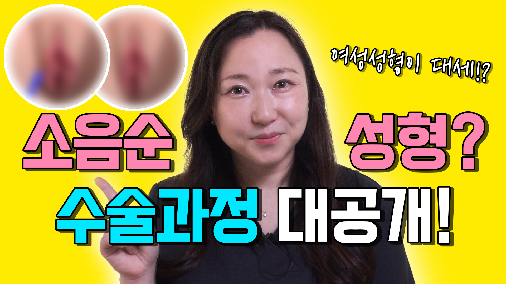 소음순성형 과정 대공개! 소음순수술 시 주의사항은 뭘까?