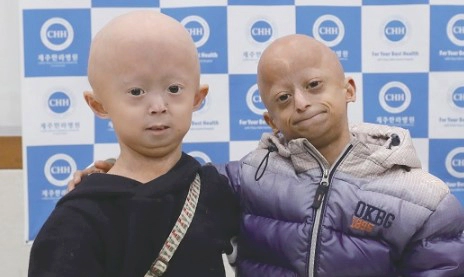 소아조로증 수명