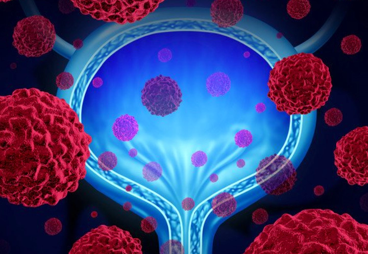 전립선-비대증-치료제-및-영양제