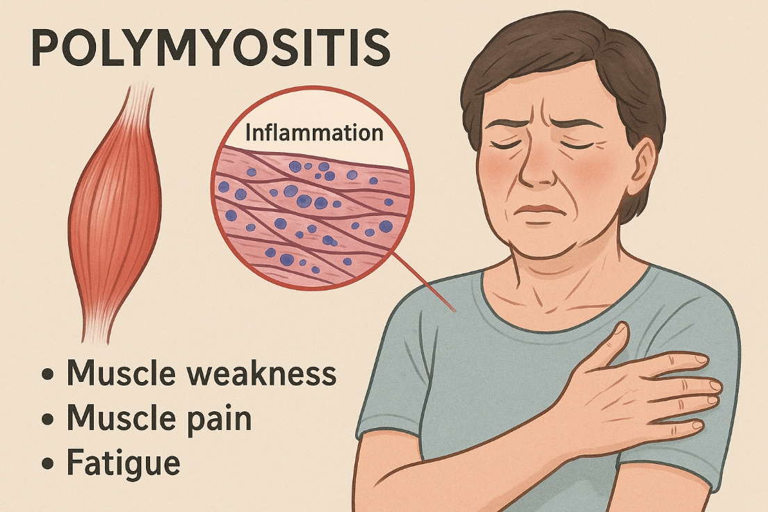 다발성근염 관련 자료 사진