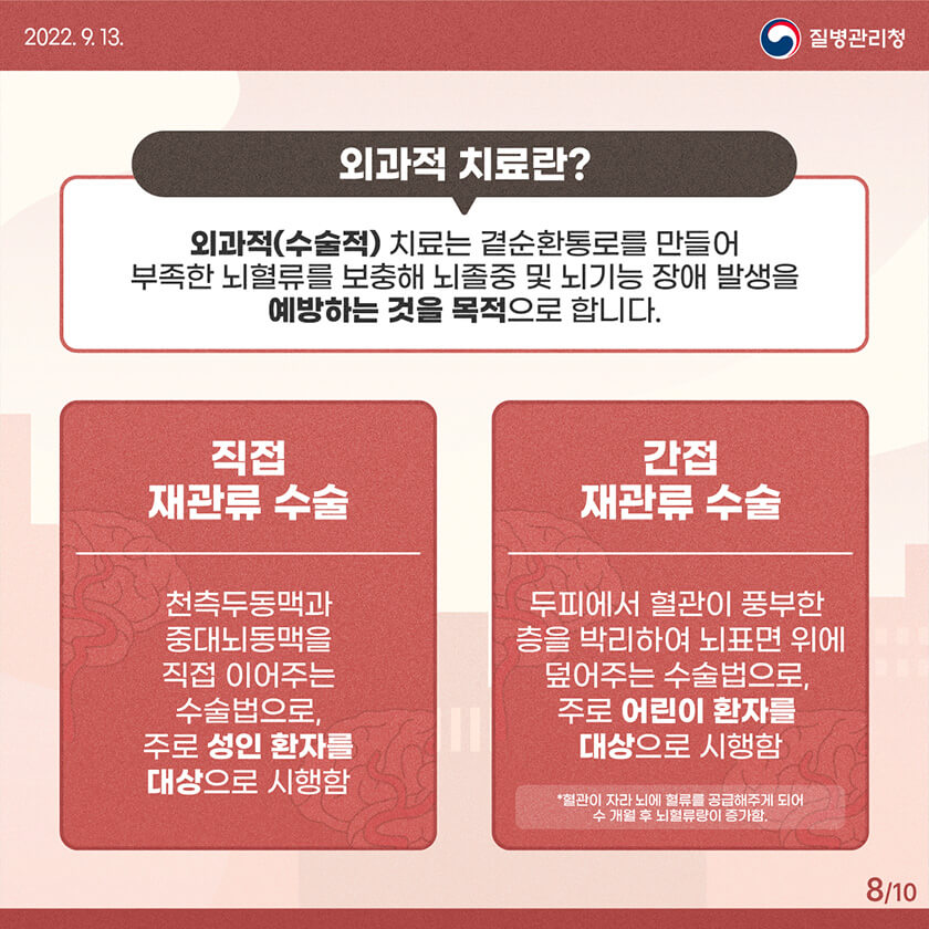 모야모야병 증상, 초기에 잡아야 하는 이유