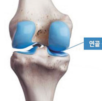 관절-연골-이미지-사진