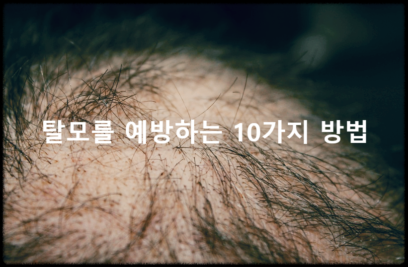 탈모를 예방하는 10가지 방법