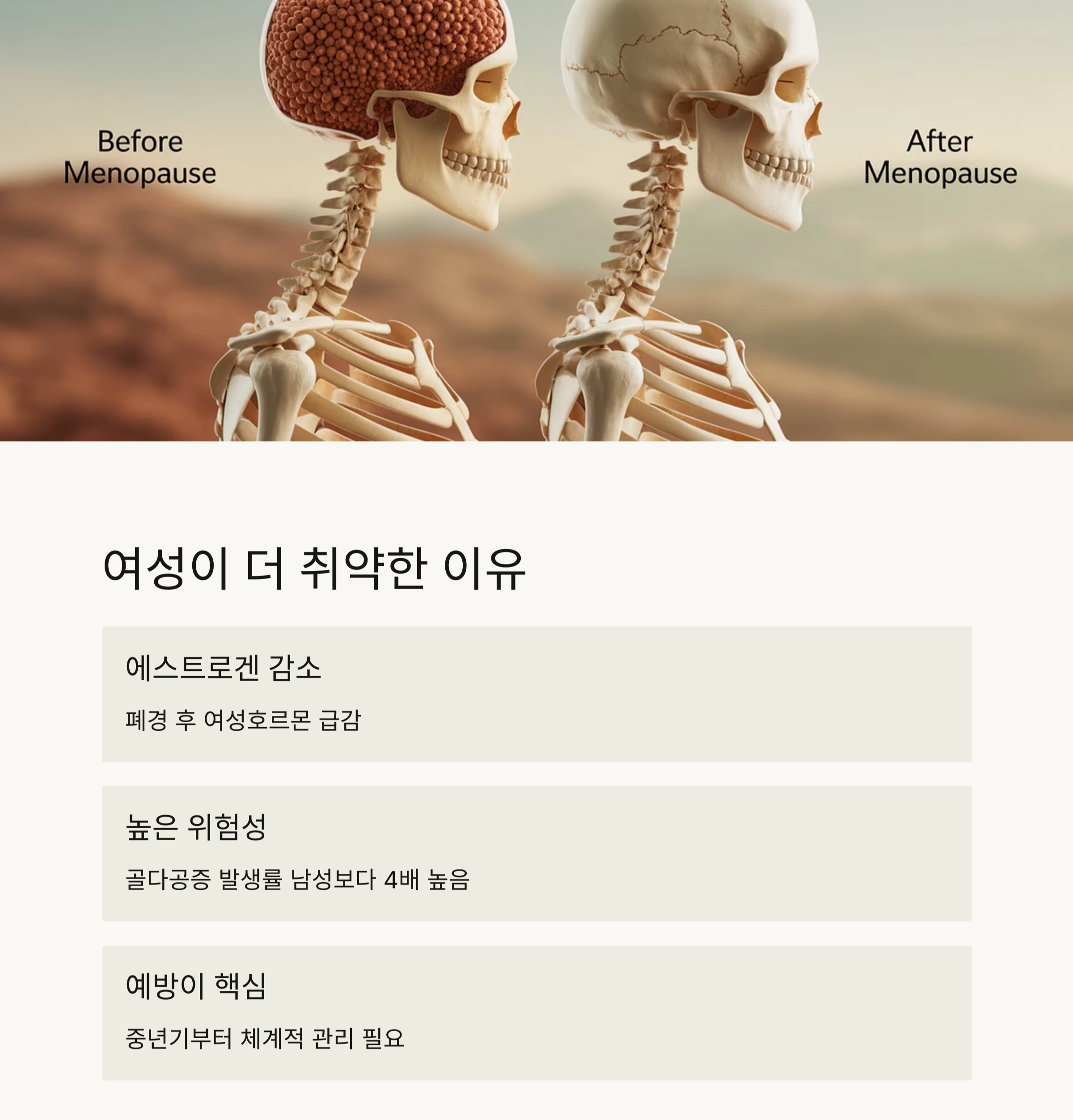 중년 여성 뼈 건강, 지금부터 시작해야 늦지 않습니다