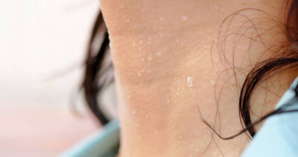 도한증 단순한 땀이 아닌 질환의 신호