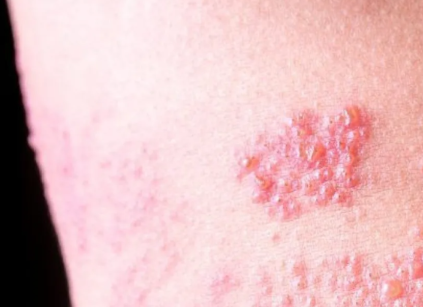 ๋์ํฌ์ง ์๋ฐฉ์ ์ข
๊ฐ๊ฒฉ