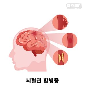 당뇨병 초기증상