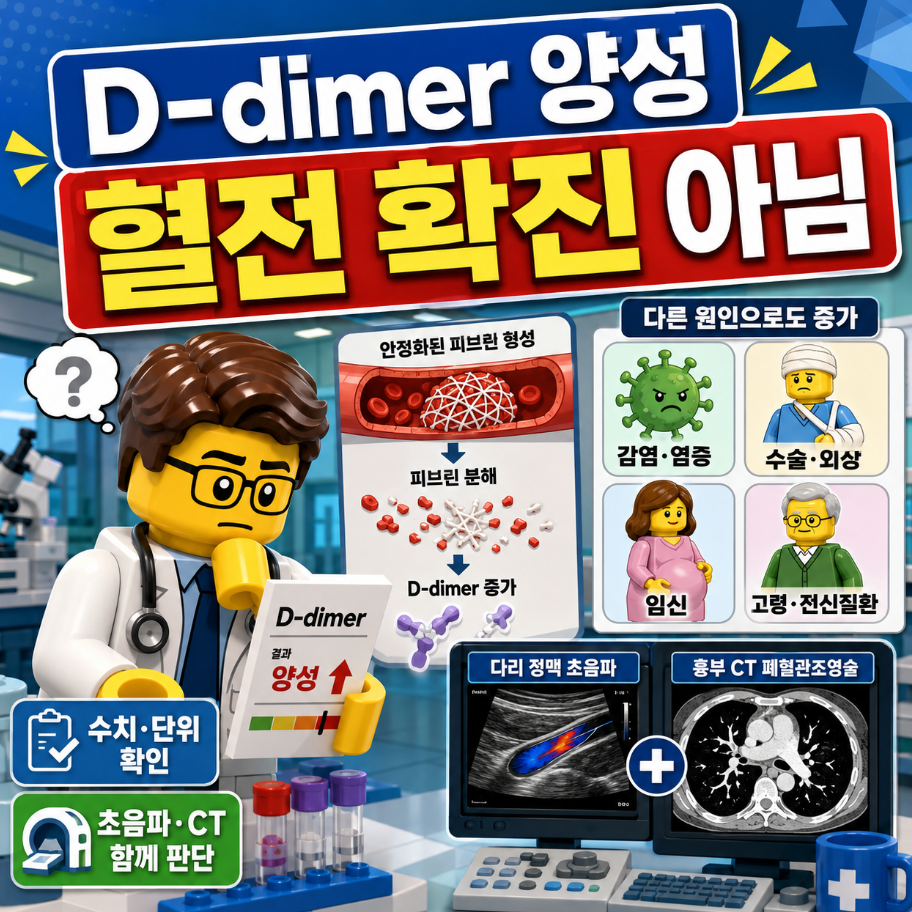D-dimer 검사 양성이어도 혈전을 확진할 수 없음을 설명하는 레고 스타일 의료 인포그래픽