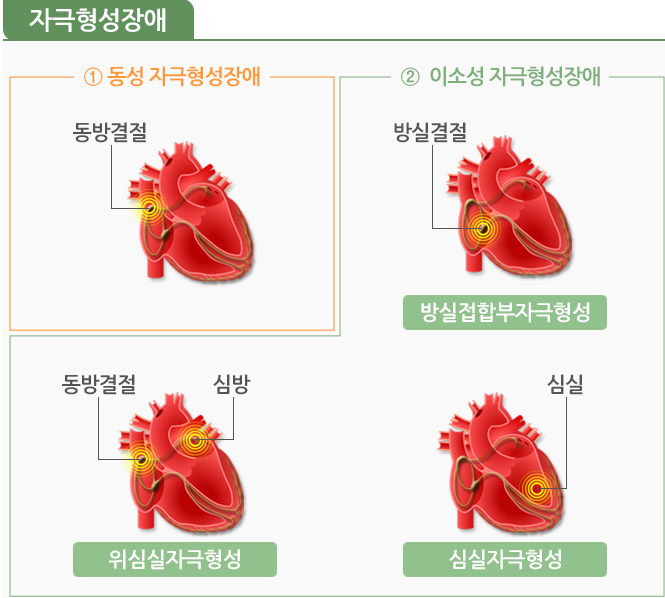 부정맥 증상