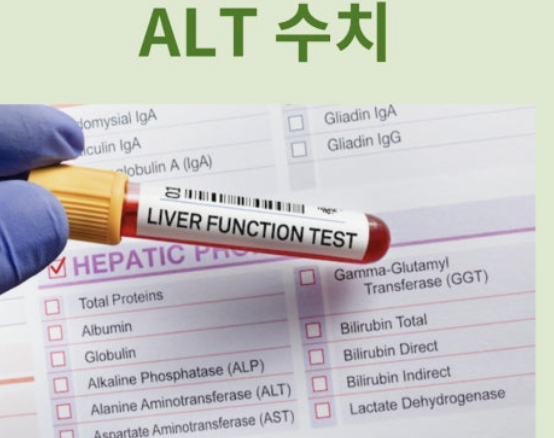 alt수치가 높으면