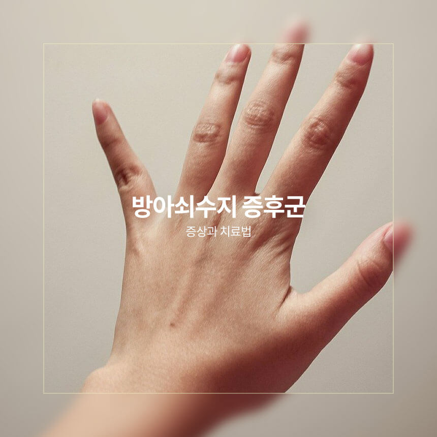 “방아쇠수지-증후군-증상-치료법”