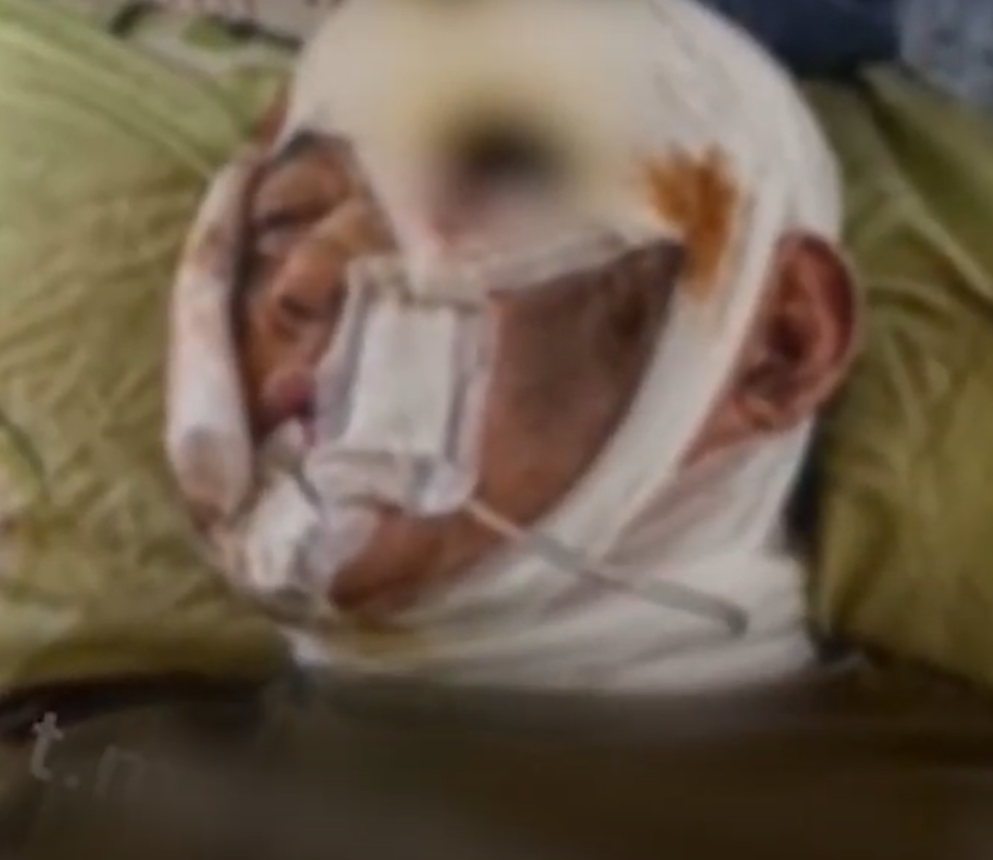 북한 러시아 무기 지원과 최고 특수부대 파병 이유