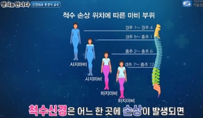 척수척추종양