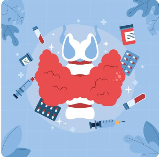 갑상선암 초기증상