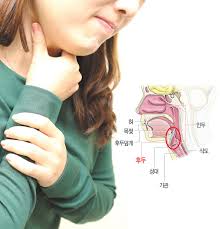 기침이 오래가면 의심되는 질병