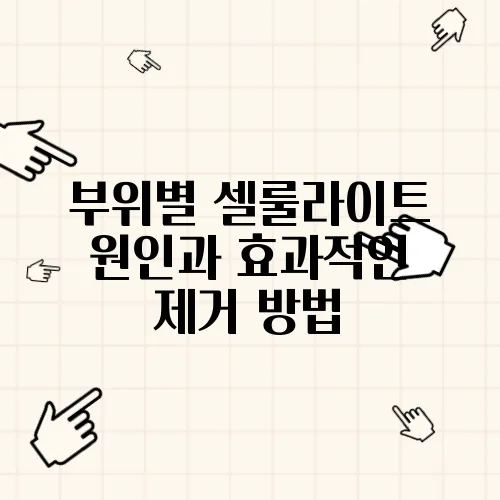 부위별 셀룰라이트 원인과 효과적인 제거 방법