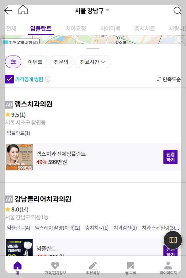 임플란트 가격비교