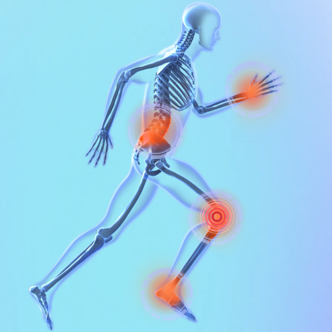 도꼬마리 관절 건강 증진