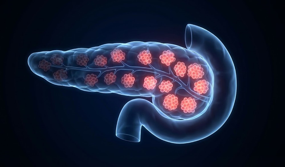 베타세포를 망치는 의외의 &lsquo;건강 습관&rsquo; 7가지&amp;#44; 대부분 좋다고 믿는다