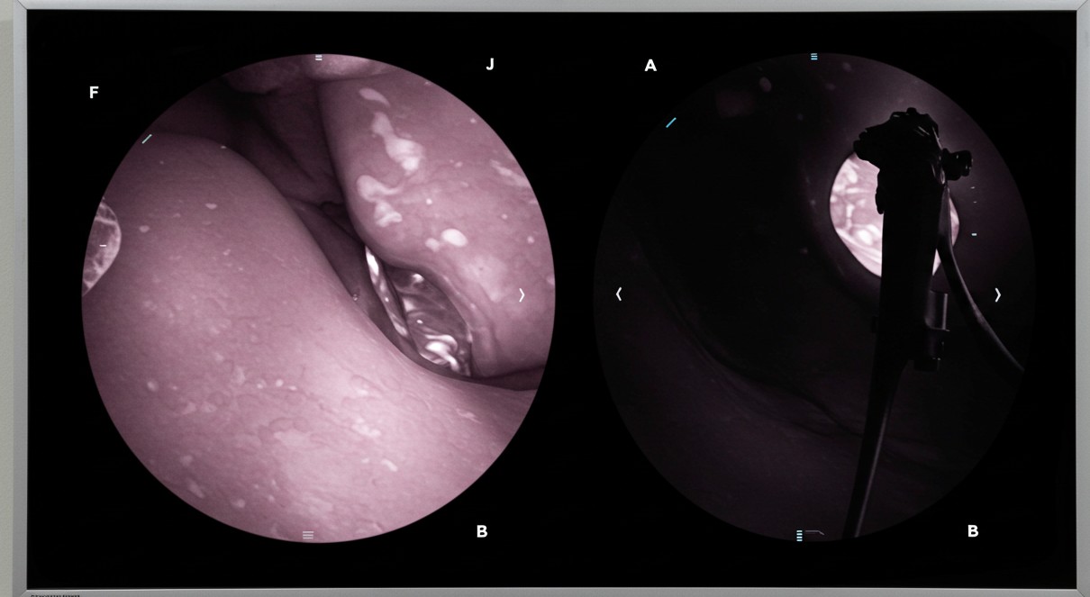 국민건강보험 위내시경 정책 변화, 꼭 알아두어야 할 검진 주기 개정안