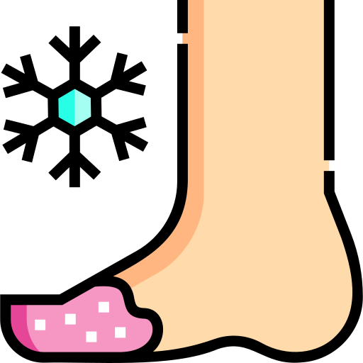 발가락동상 증상과 발가락동상 치료방법, 발가락동상 치료법