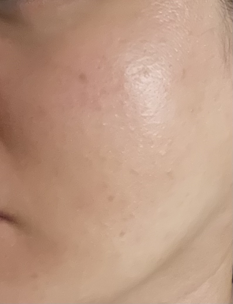 엑소프록실 시카 엑소좀 미네랄 워터 토너패드