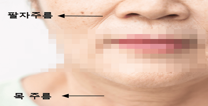 물광주사가-필요한-여성