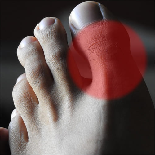 엄지발가락과 통증