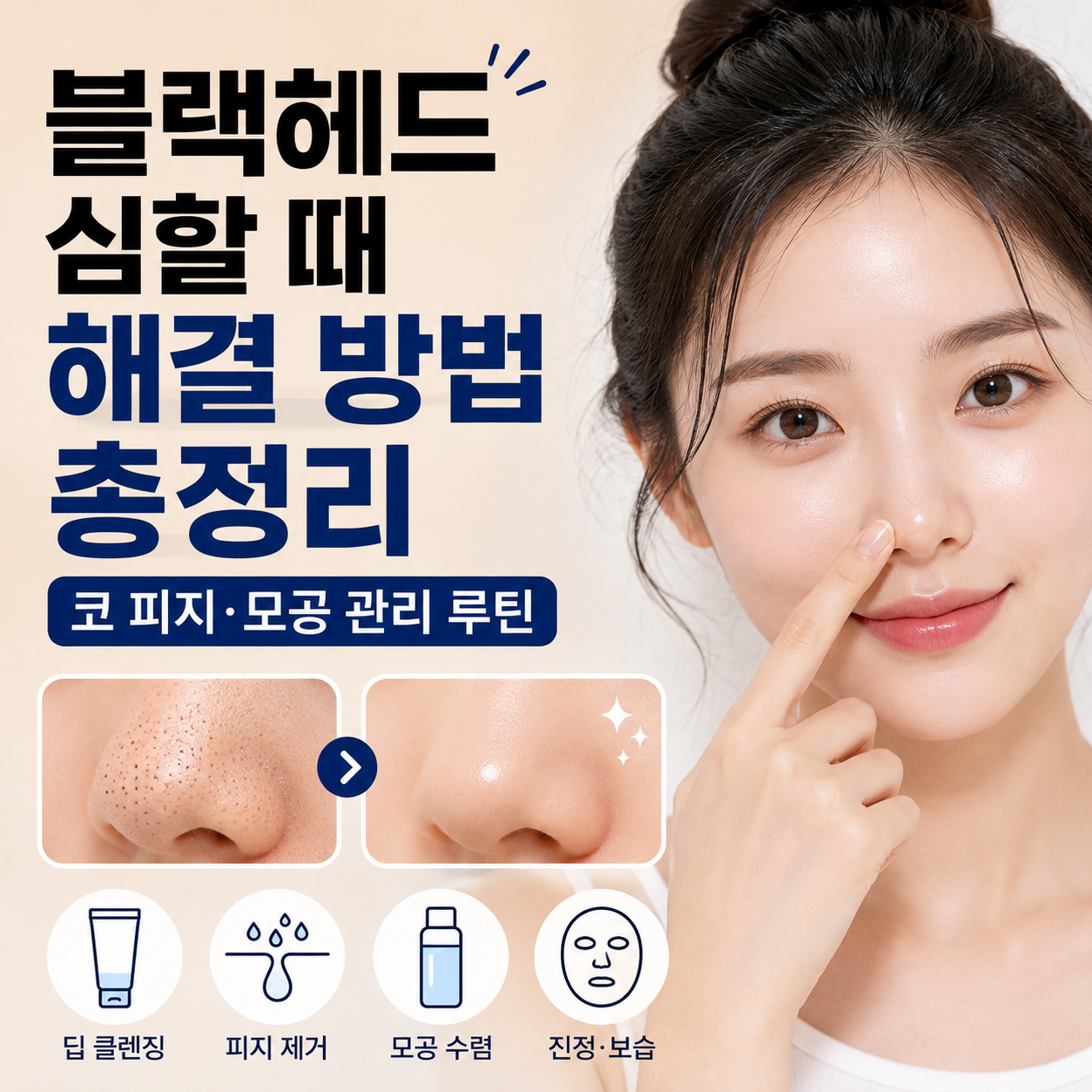 블랙헤드 심할 때 해결 방법
