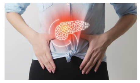 췌장암초기증상