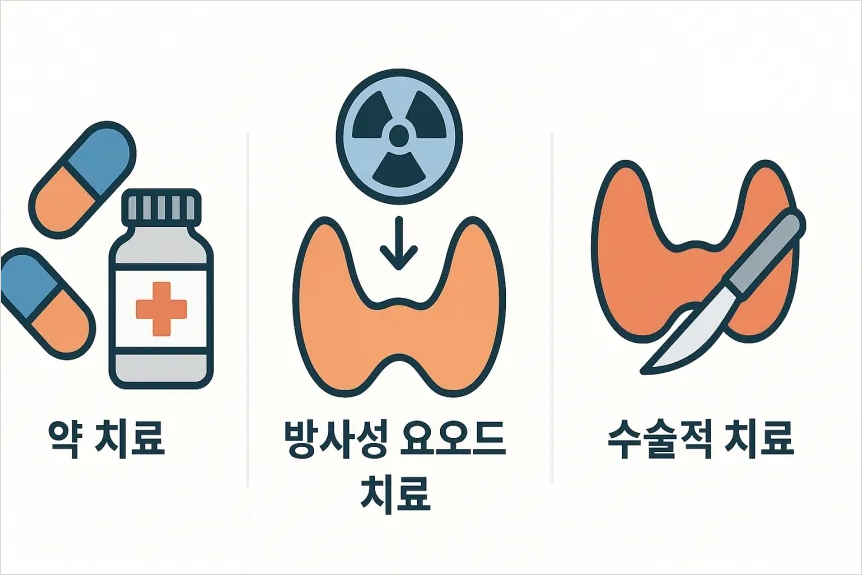 갑상선 기능 항진증 치료
