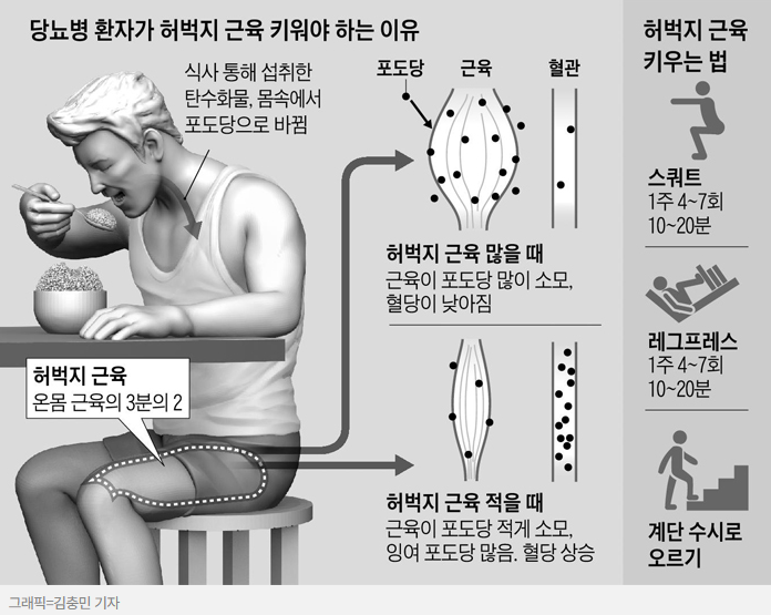 당뇨병 환자가 허벅지 근육을 키워야 하는 이유