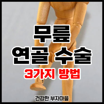 무릎 연골 수술