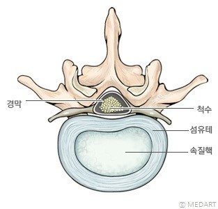 강아지척추안-강아지척추사이원반