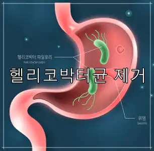 매스틱 효능
