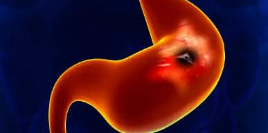 🫄배가 아픈 위치로 알아보는 질환 지도(복통 부위에 따른 질환)