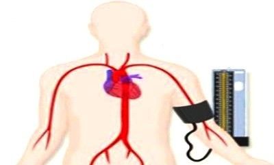 저밀도 콜레스테롤 정상수치