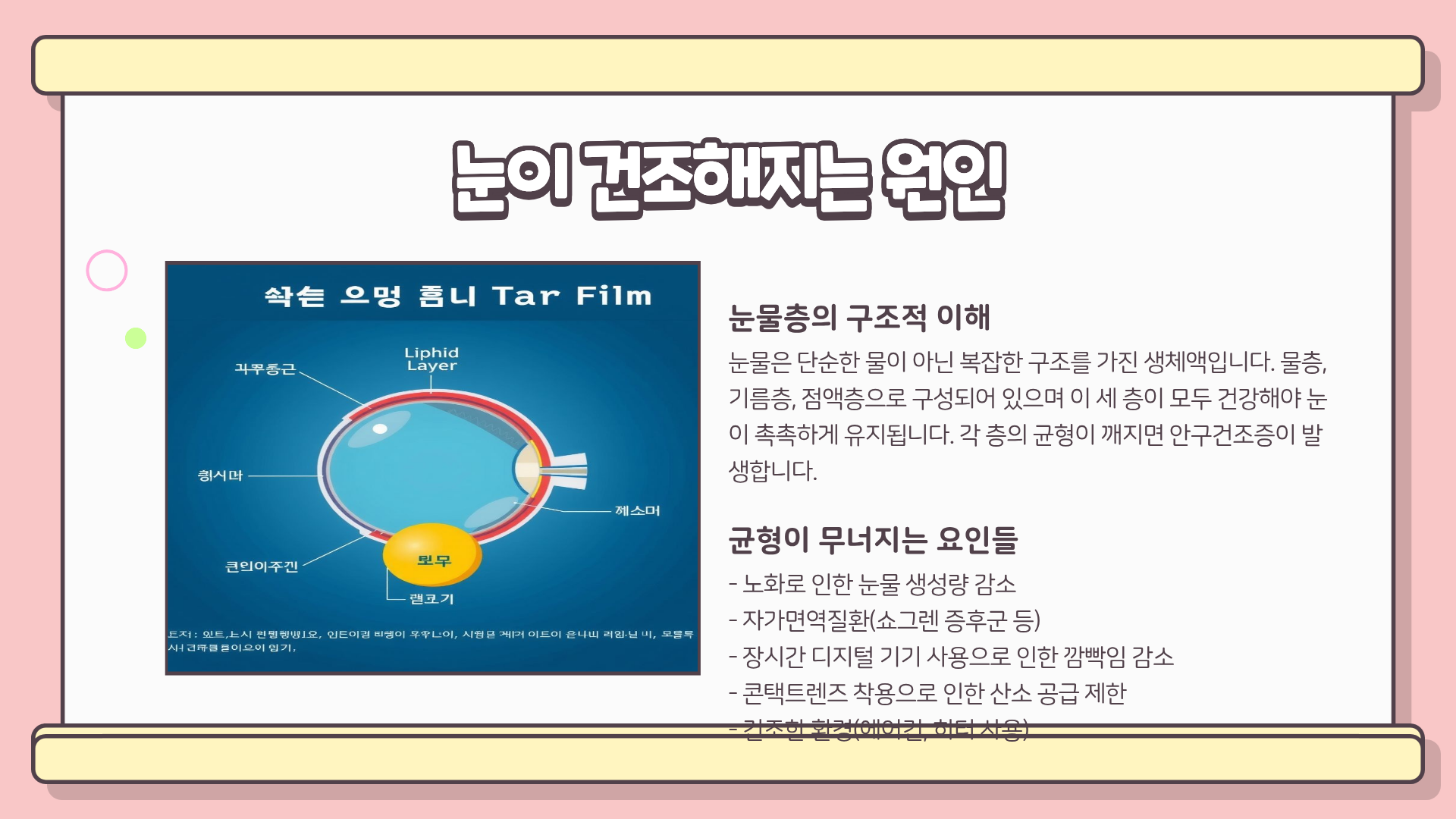 안구건조증 치료 | 안구건조증 증상 | 안구 건조증 민간요법 완전정복 가이드