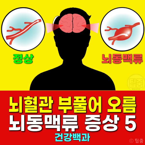 뇌동맥류 증상 뇌혈관 팽창