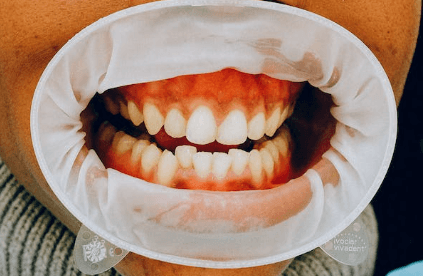 이 꿈해몽