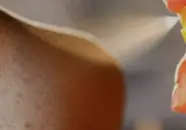 땀띠 원인과 증상 &amp; 치료