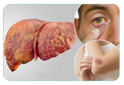 간기능 개선제 추천