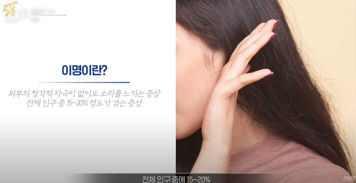 이명 정의