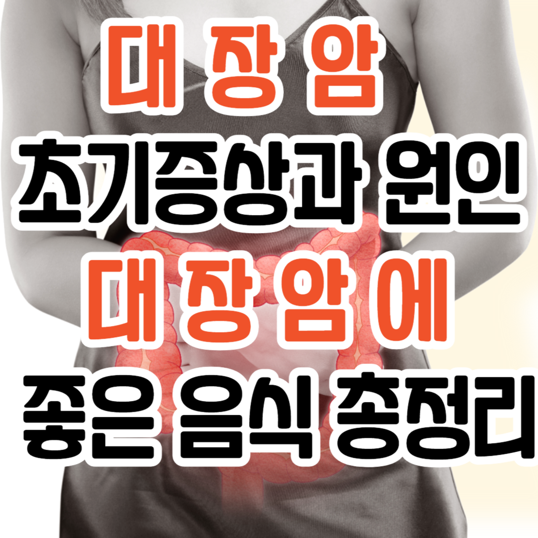 대장암/ 초기증상과 원인 / 대장암에 좋은 음식 총정리